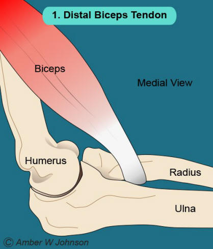 Figure 1: Distal Biceps Tendon